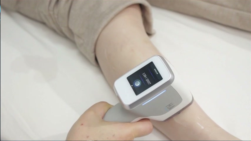 Cadru real din clip: aplicatorul laser diode în timpul tratamentului